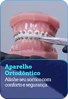 Aparelho