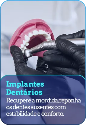 implantes